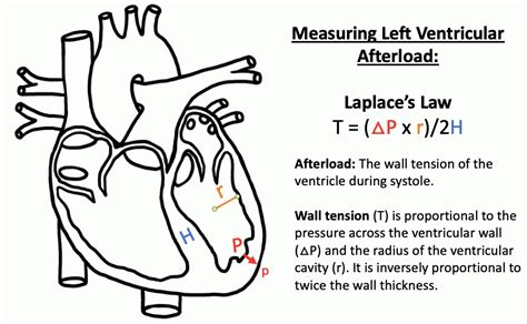 lv toe|severe lvoto surgery.